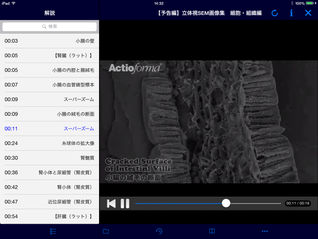Comentary view