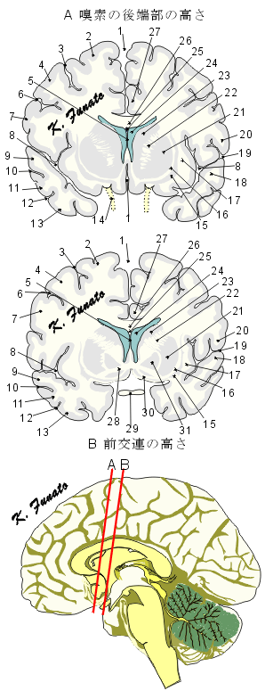 olfactorius_rostralis.gif (55046 バイト)