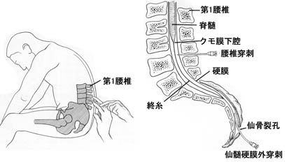 anatomy16a-0.jpg (19593 バイト)