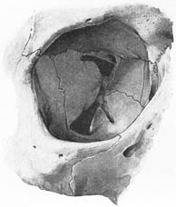 anatomy1b3-13.jpg (12739 バイト)